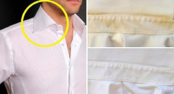 Como remover manchas amareladas de roupa branca